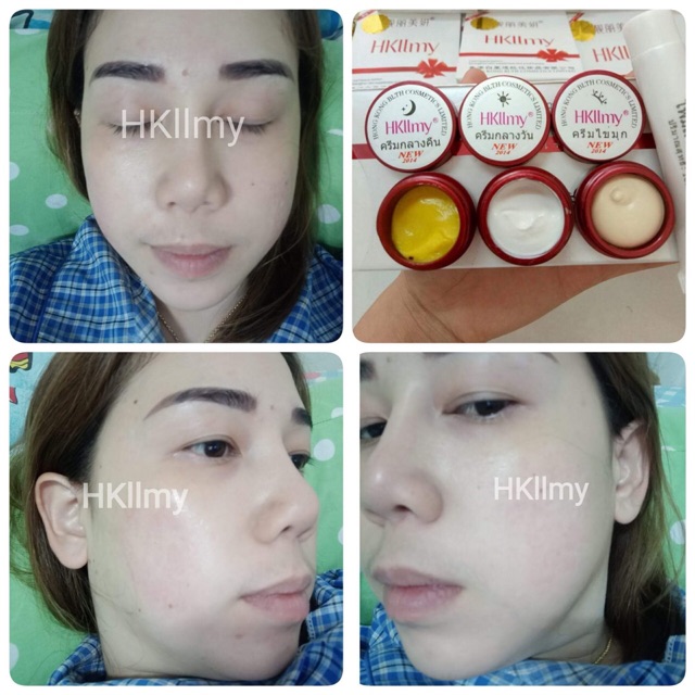HKllmy 2014 เซตทดลอง พร้อมส่ง(แถมแมสwelcare)