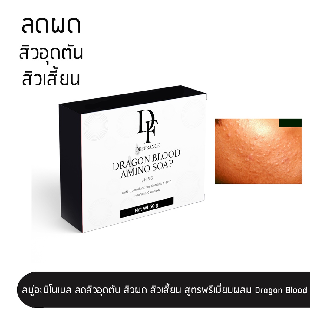 Derfrance Dragon Blood Amino Soap 50 g. l สบู่อะมิโนเบสเกรดพรีเมี่ยม ลดสิวเสี้ยน สิวอุดตัน สิวผด pH 5.5