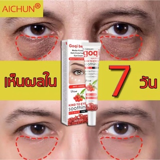 aichun ครีมลดถุงใต้ตา อายครีมบำรุงรอบดวงตา 20ml อายครีม ขอบตาดำ สามารถลดถุงใต้ตา แบ่งเบาริ้วรอย ลดใต้ตาดำ ครีมลดใต้ตาดํา