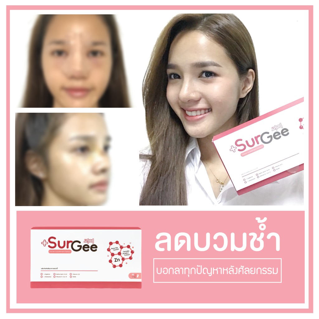 Surgee เซอร์จี้ ยาลดบวม ลดรอยช้ำเร่งสมานแผลหลังศัลยกรรม