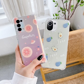 เคส Realme 10 10 Pro 10 Pro+ C53 C33 C55 C30 C30s 9Pro 9Pro+ C35 8 5G C25 C25s C21 8 7 Pro 7i C17 C11 C12 C15 3 Pro 5 Pro 5i 5s 2 Pro 6 Pro 6i  C3 เคสซิลิโคนTPU สีใส กันกระแทก สำหรับ