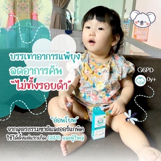 ยาลดรอยดำจากยุงกัด โยเดียบีบาล์ม Yodia B Blam ลูกน้อยขาไม่ลายอีกต่อไป
