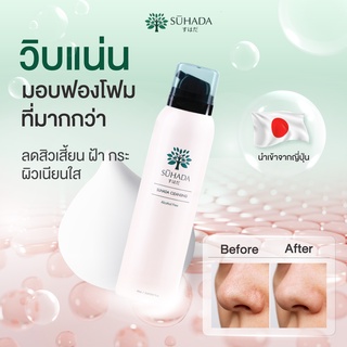 Suhada Soda Cleansing Foam ซึฮาดะโซดาคลีนซิ่งโฟม ทำความสะอาดผิวหน้าแบบ 3 in 1