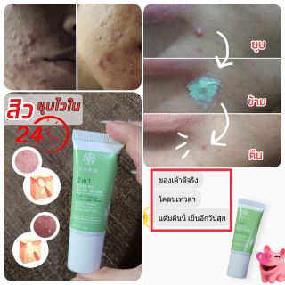 สิวยุบข้ามคืน Neem 2in1 Teatoc Clay Mask แต้มสิวยุบ24ชม.ด้วยโคลนฝรั่งเศส และ tea tree by Neem natural