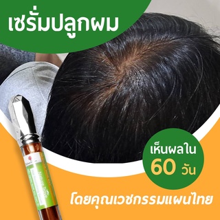 เซรั่มปลูกผม คิ้ว จอน ขนตา จากสารสกัดโสม และใบแปะก๊วย เห็นผลจริง ไม่มีผลข้างเคียงเพราะสกัดจากวัตถุดิบธรรมชาติ