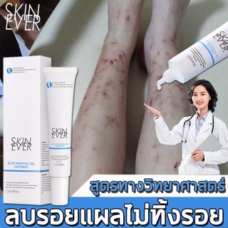 สูตรปลอดภัย SKINEVER แก้รอยแผลเป็น ยาทาแผลเป็น ครีมลดรอยแผลเป็น ครีมแก้ขาลาย ลดรอยเเผลเป็น ครีมทาแผลเป็น