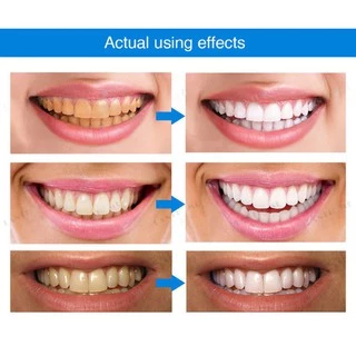 ฟอกฟันขาว ฟันขาว น้ำยาฟอกฟันขาว ที่ฟอกฟันขาว ยาฟอกฟันขาว น้ำยาขัดฟันขาวTeeth Whitening Pen ปากกาฟอกฟันขาว เจลฟอกฟันขาว