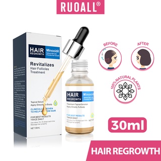 100% การเจริญเติบโตของเส้นผม Hair Growth Essential Oil Serum สำหรับผู้ชายและผู้หญิง ป้องกันผมร่วง เสริมสร้างผม