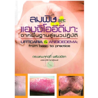 ลมพิษและแองจิโออีดีมา :จากพื้นฐานสู่แนวปฏิบัติ (URTICARIA &amp; ANGIOEDEMA: FROM BASIC TO PRACTICE) (9786165728966)