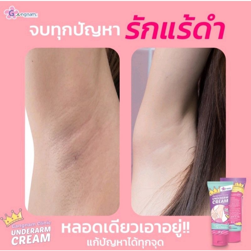 พร้อมส่ง สินค้ามีตำหนิ❗Under arm cream by Gangnum clinic