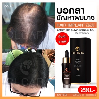 2 แถม 1 cleara เคลียร่า เซรั่มปลูกผม ปลูกผม น้ำยาเร่งผมยาว ป้องกันผมร่วง  เซรั่มปลูกหนวด ยาปลูกผม