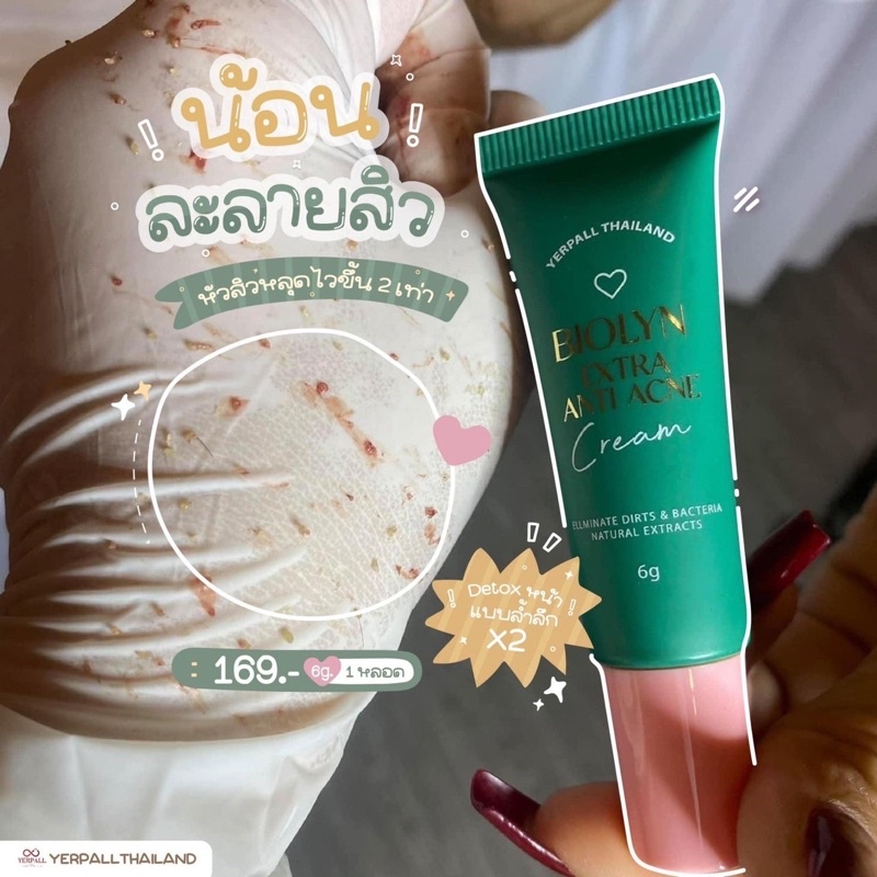 [พร้อมส่ง 🎇] ละลายสิวไบโอลีน biolyn🌳 ฆ่าเชื้อสิว ลดสิวอุดตัน by yerpallthailand