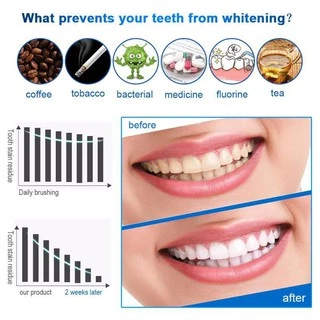 ฟอกฟันขาว ฟันขาว น้ำยาฟอกฟันขาว ที่ฟอกฟันขาว ยาฟอกฟันขาว น้ำยาขัดฟันขาวTeeth Whitening Pen ปากกาฟอกฟันขาว เจลฟอกฟันขาว