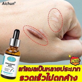 Aichun ครีมลบแผลเป็น 30ML ครีมลดรอยแผล เจลลบรอยแผลเป็น ครีมทาแผลเป็น ครีมลบรอยแผลเป็น แผลน้ำร้อนลวก ครีมลดรอยสิว