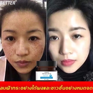 【ซื้อ 2 แถม 1】BETTER ครีมทาฝ้าลึก 30g ละลายคราบจุดด่างดำ ครีมทาฝ้าหนาๆ ครีมทาฝ้ากระ ครีมลดฝ้าลดกระ