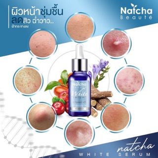 เซรั่มณัชชา(Natcha)หน้าใส บอกลาฝ้า