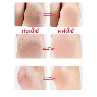 YOTAI ซิลิโคนรองส้นเท้า ใส่ได้ทั้งชายหญิง ถนอมส้นเท้า แก้ปวดส้นเท้า รองช้ำ ส้นเท้าแตกของแท้ แพ็คคู่