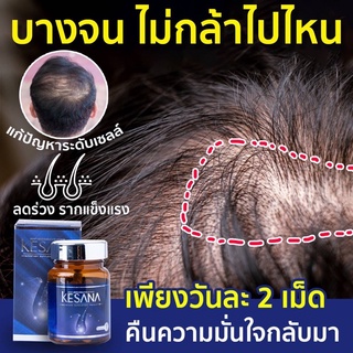 KESANA (เคซาน่า) ปลูกผม หยุดร่วง ทันใจ หายร่วงไวด้วยวิตามินอัดแน่น 17 ชนิด