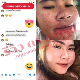 DR.SAROJ(ของแท้) ดร.สาโรช (Dr.Saroj) โลชั่นรักษาสิว สำหรับสิวอุดตัน (ทาทั่วหน้า) 60 ml.