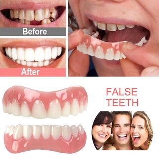 แฟชั่นวงเล็บเครื่องสำอางฟัน Perfect Instant Smile Veneers Comfort Fit สำหรับ Top ทันตกรรมวงเล็บ Bra