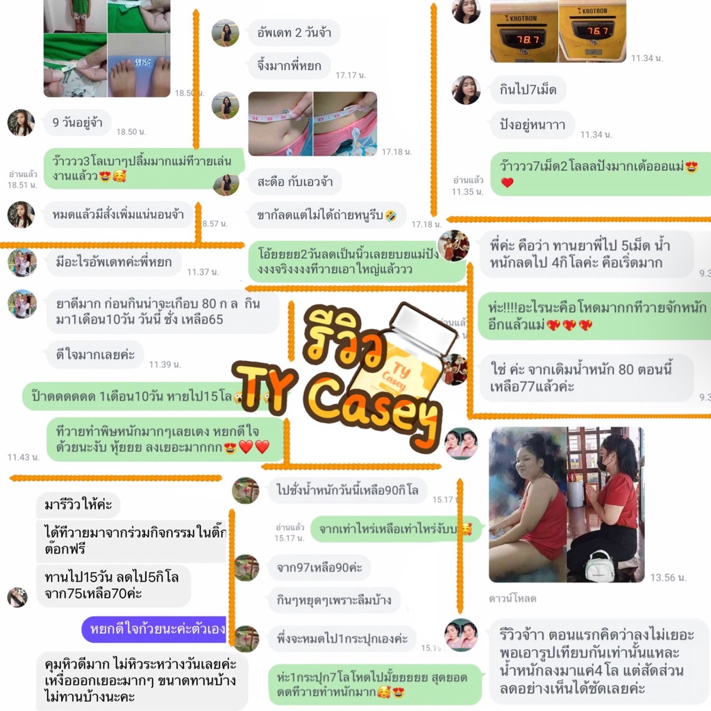 TY Casey (ทีวายเคซี่ย์) - รูปที่ 3