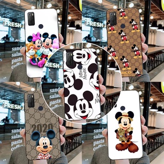 เคสโทรศัพท์มือถือซิลิโคน TPU แบบนิ่ม พิมพ์ลายมิกกี้ เมาส์ สําหรับ Alcatel 1S 3L 2021 6.52 นิ้ว