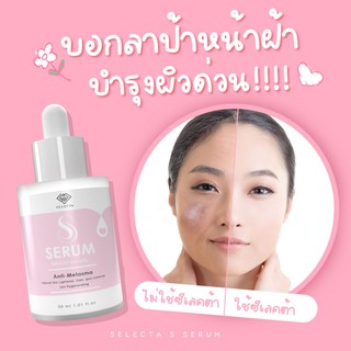 เซรั่มแก้ฝ้า บำรุงผิวหน้ากระจ่างใส Selecta S Serum หน้าหมองคล้ำ เซรั่มหน้าใส