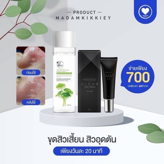 Set สิวเสี้ยน สิวอุดตัน 💯