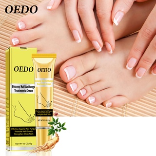 OEDO โสมเล็บ ครีมบํารุงเล็บป้องกันการเชื้อราสําหรับดูแลเล็บเท้า ครีมบำรุงเท้า 15 กรัม
