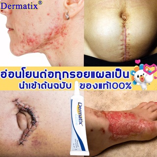 ‍️รอยแผลเป็นจางลง อ่อนโยนและทรงพลัง‍️Dermatix ครีมทาแผลเป็น น้ำร้อนลวก แผลเป็น น้ำร้อนลวก แผลไฟไหม้ แผลผ่าตัด รอยแตกลาย