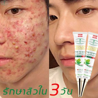 AICHUNครีมไวท์เทนนิ่งฝ้า ครีมลดฝ้า ครีมแก้ฝ้า ครีมรักษาฝ้า กระ herbal ครีมฝ้ากระ ครีมทาฝ้า ทรีทเม้นท์&amp;เซรั่มฝ้ากระ