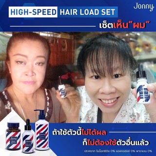 จอนนี่แอมเพิล 30 ml +แชมพู + วิตามิน