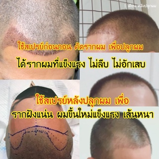 สเปรย์กระตุ้นบำรุงรากผม Blove (บีเลิฟ) Restror Hair Tonic:HT สเปรย์ปลูกผมนวัตกรรมใหม่