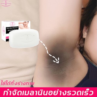 ช่วยแก้ผิวเหลือง Aichunสบู่ล้างหน้า100g ฟอกตัวกระจ่างใส ทำให้เมลานินจางลง ทำความสะอาดล้ำลึก กำจัดไรการควบคุมความมันแล้ว