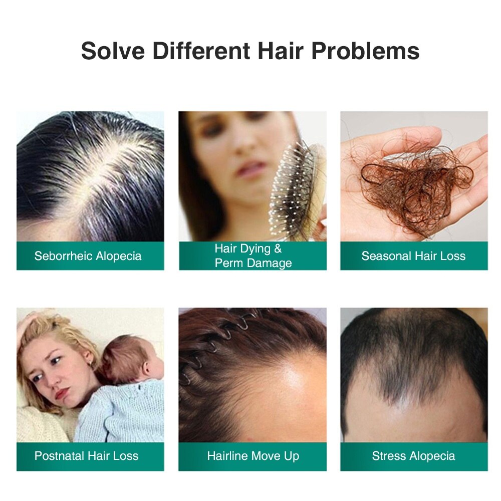 New Ginger Hair Growth Essential Spray Anti Hair Loss Serum 7 Days  Effective Germinal Repair Growing Treatment Liquid | Shopee Thailand