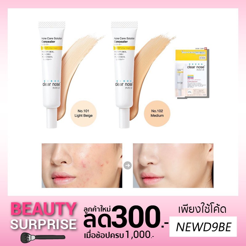 Clear nose acne care solution concealer เคลียร์โนส แอคเน่ แคร์ โซลูชั่น คอนซีลเลอร์ สำหรับผิวเป็นสิว
