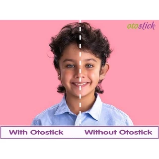 🔥แก้หูกาง🔥 OTOSTICK 2 แพ็ค แบบเนียนเป็นธรรมชาติสุด ยกกล่อง ล็อตใหม่ล่าสุด ฟรีแผ่นแอลกอฮอล์