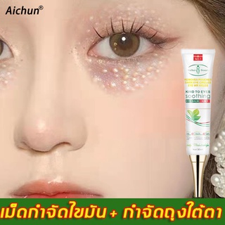 Aichun อายครีม,ลดริ้วรอยรอบดวงตา,ขจัดอนุภาคไขมัน30ml(ครีมทารอบดวงตา,ลดถุงใต้ตา,เม็ดไขมัน,ให้ความชุ่มชื่น,ครีมทาใต้ตาดำ)