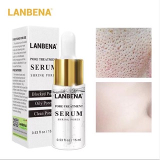 LANBENA ครีมบำรุงหน้า เซรั่มบำรุงหน้าขาวใส กระชับรูขุมขน คุมมัน ซ่อมแซม ทำให้ผิวเรียบเนียน 15ml