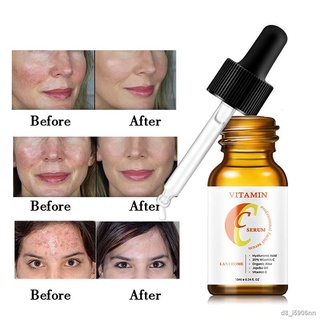 10ml Face Care Vitamin C Essential Oil Serum Anti Wrinkles Whitening Facial Essence Acne Freckle Stretch Mark Removal VC