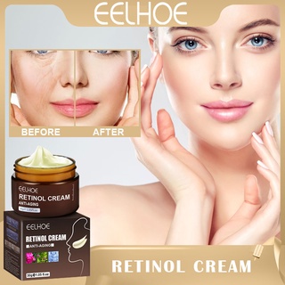 Eelhoe ครีมบํารุงผิวหน้า เรตินอล 2.5% ครีมบํารุงรอบดวงตา ต่อต้านริ้วรอย กรดไฮยารูลอนิก ครีมต่อต้านริ้วรอย ครีมเรตินอล ครีมลดริ้วรอย ครีมลดสิว ไวท์เทนนิ่ง 30 มล.