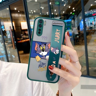 เคส Oppo A91 A92 A52 A92s Reno4 Z 5G A31 2020 (ขาตั้งสายรัดข้อมือ) เคสโทรศัพท์มือถือ แบบใส ขอบนิ่ม ลายการ์ตูนแมวทอม ชีสซน