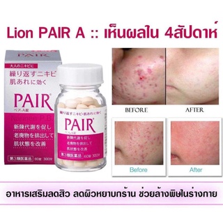 🇯🇵LION PAIR A วิตามินลดสิว🇯🇵 ( 30 | 60 Days)