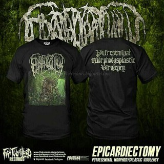 Ts epicardiectomy - พัตรีสมินัล