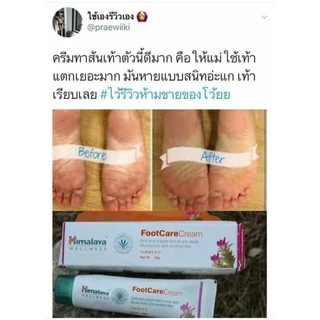 (ซื้อในไลฟ์ 64 บาท)ขนาดใหญ่ ครีมดูแลส้นเท้าแตกและเท้าที่หยาบกร้าน 50gHimalaya Foot Care Cream