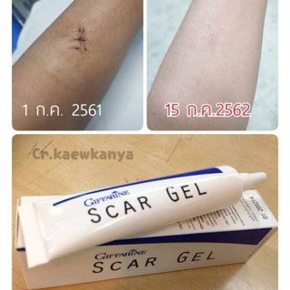 กิฟฟารีน ครีมลบรอยแผลเป็น รอยดำ รอยแผลสิว สการ์เจล ครีมลบเลือน รอยแผลเป็น สูตรเข้มข้นพิเศษ Giffarine