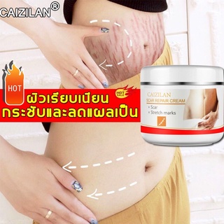 ( ทั้งร้านทุกอย่าง 58 บาท ) CAIZILAN ครีมลดรอยแตกลาย 30ml แก้ปัญหารอยแตกลาย คืนความยืดหยุ่นและความเงางาม ครีมทาท้องลาย