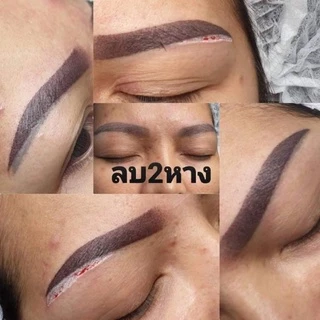 ผลิตภัณฑ์สำหรับลบรอยสัก ลบคิ้วปลิง คิ้วสองหาง