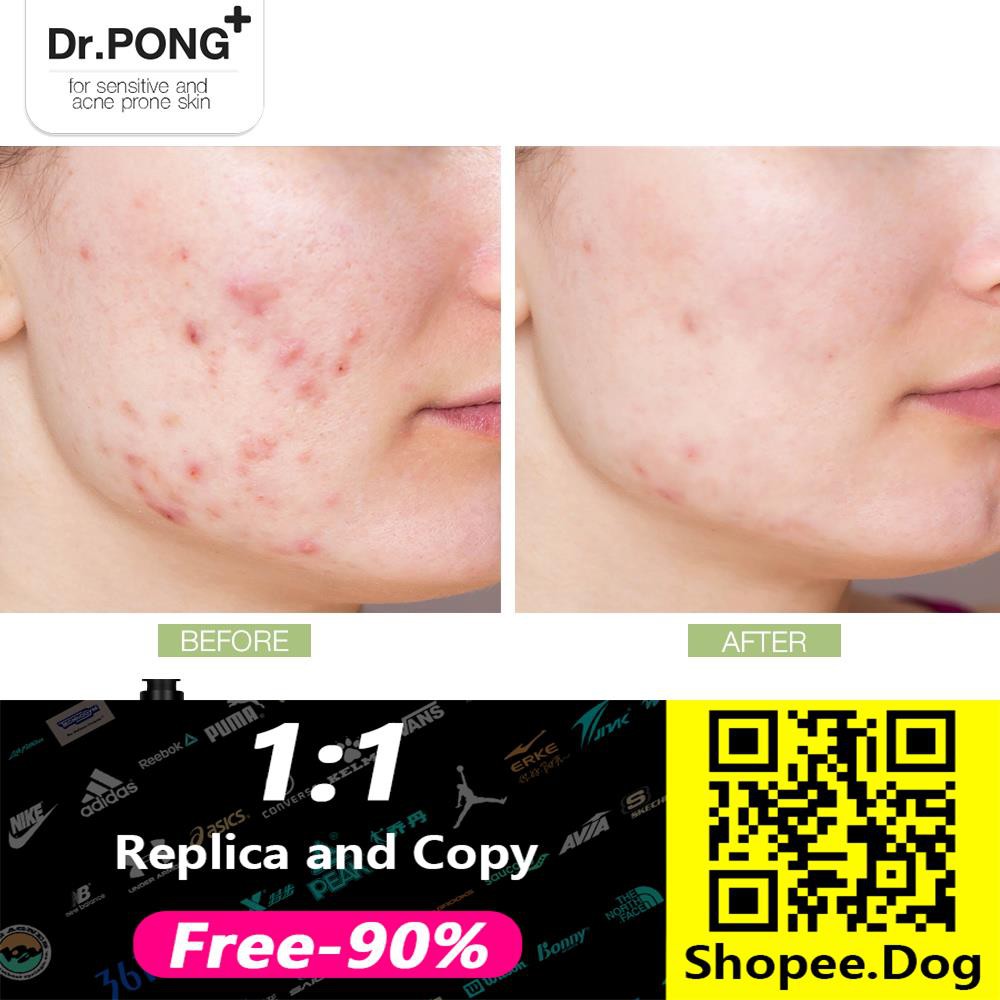 ◐♚☈Dr. PONG Acne Clear Glowing Toner โทนเนอร์สำหรับคนเป็นสิว Tea tree oil - Niacinamide - BHA - Zinc