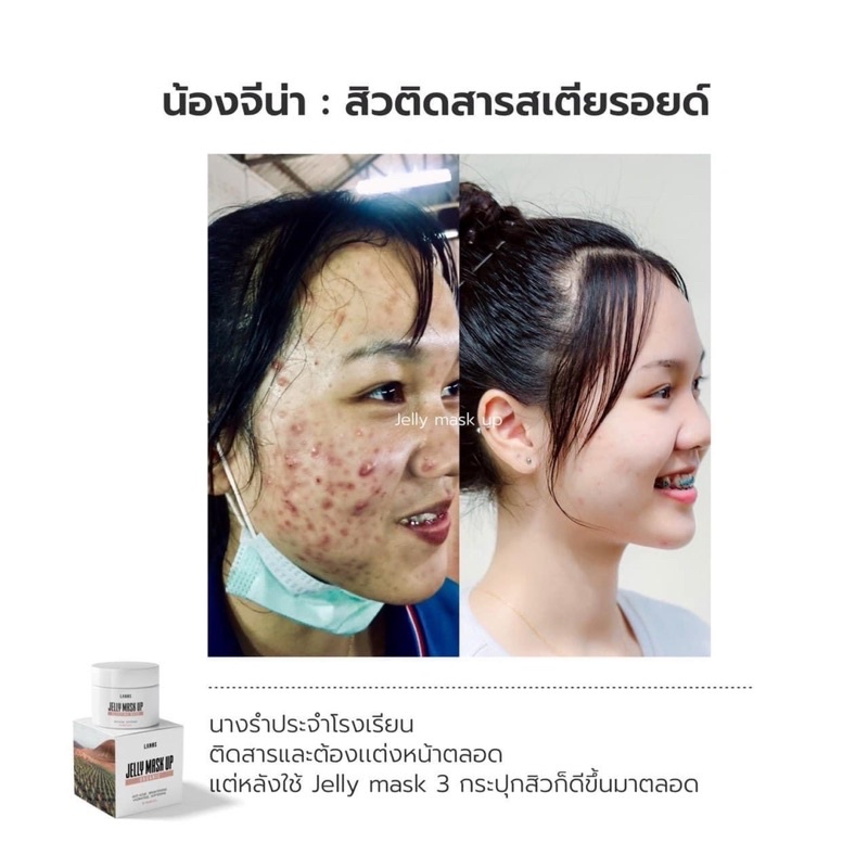 เจลลี่มาส์กลานอส มาส์กเจลลานอส Jellymask up แพ็คเกจใหม่ ลดสิว ออแกนิค [ ของแท้ ส่งฟรี ] [มีส่งด่วน] - รูปที่ 6